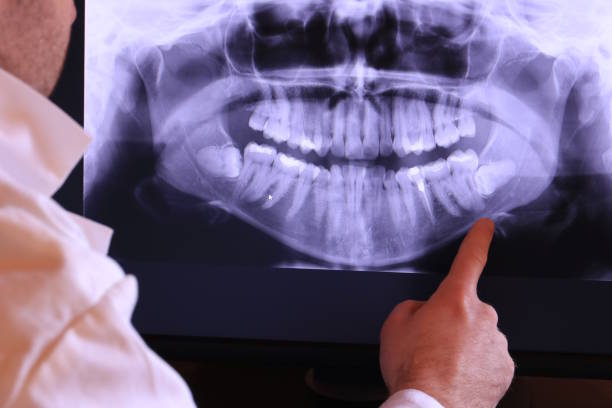 Best Urgent Care for Lost Fillings or Crowns in Leland Grove, IL