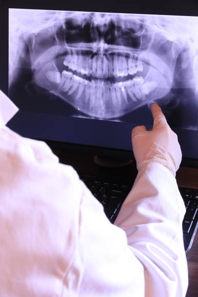 Best Emergency Tooth Extraction in Leland Grove, IL