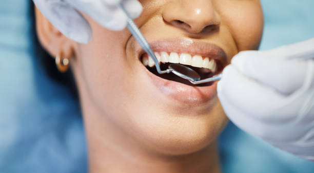 Best Emergency Gum Treatment in Leland Grove, IL
