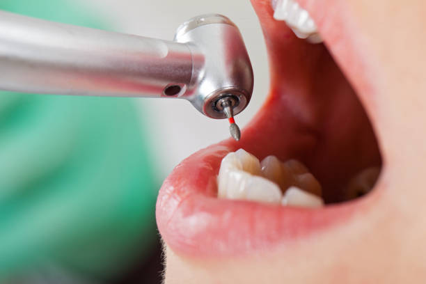Best Emergency Root Canal Treatment in Leland Grove, IL